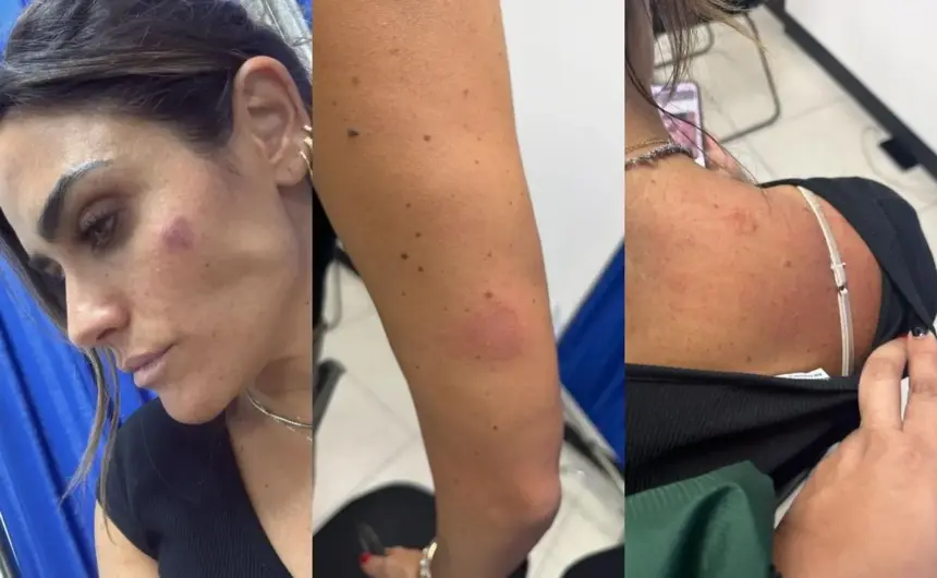 Agresión a alcaldesa de Cuauhtémoc durante operativo público